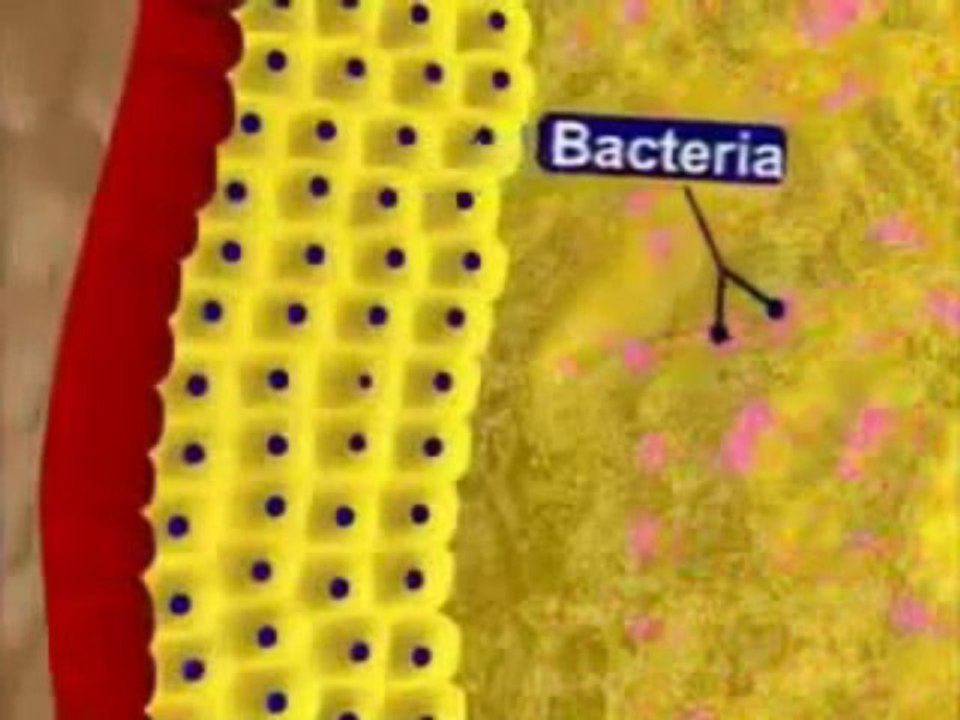 Acne No More - Bid Pimples Goodbye | Natural Treatments For Acne | Acne Remedies