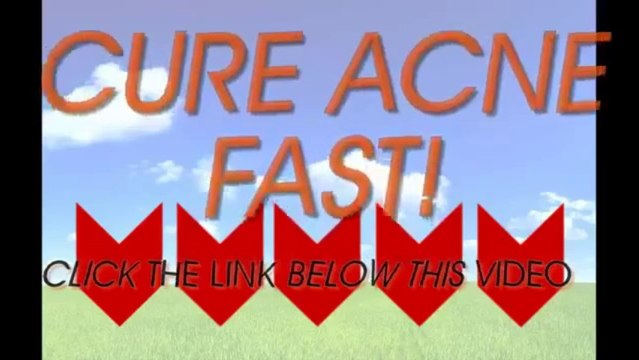 Buy Acne No More - Natural Home Remedies For Acne Scars REVIEWS