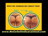 The Truth About Cellulite and What YOU Can Do To Concour it-Lose That 'Orange-Peel' Look Today!