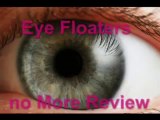 Eye Floaters no More Review - Eye Floaters Symptoms