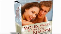 Moles Warts And Skin Tags Removal Review | Remove Moles, Warts & Skin Tags