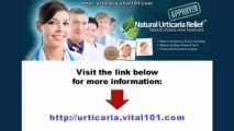 How To Treat Hives Naturally - Natural Urticaria Relief - Get Rid Of Hives - Angioedema Treatment