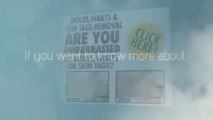MolesWarts And Skin Tags Removal SCAM-Easily, Naturally And Without Surgery