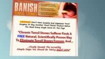 Banish Tonsil Stones Book - Removing Tonsil Stones