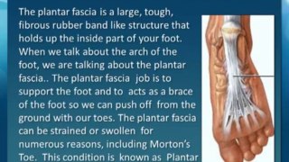 Plantar Fasciitis explained by Podiatrist of  Panama City FL