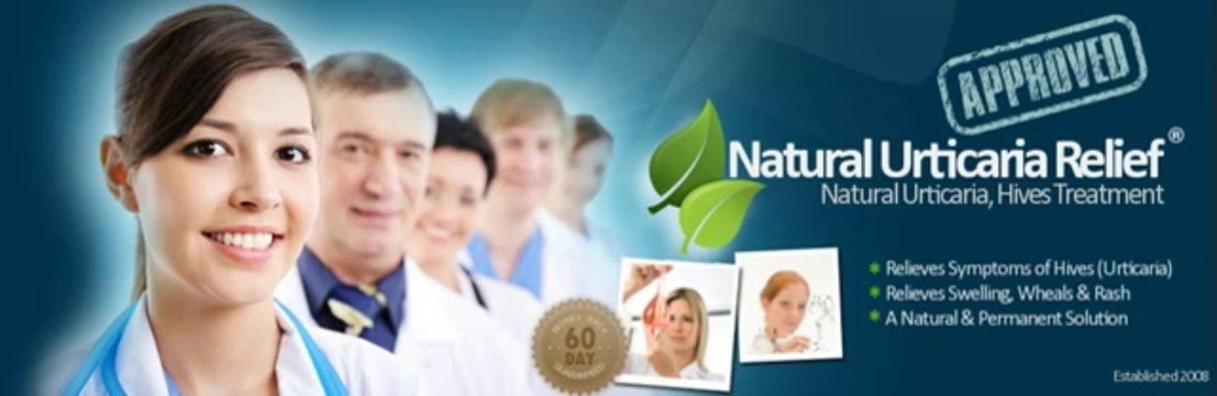 Natural Urticaria Relief-new To Cb-established & Respected Publication Review + Bonus