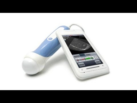 Ultrasound machine that fits in your pocket: The smartphone-based MobiUS