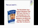 Acne No More Review - What Are the External Skin Care Secrets | Acne Remedies