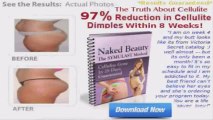Exclusive Truth about cellulite joey atlas reviews Truth about cellulite joey atlas reviews1