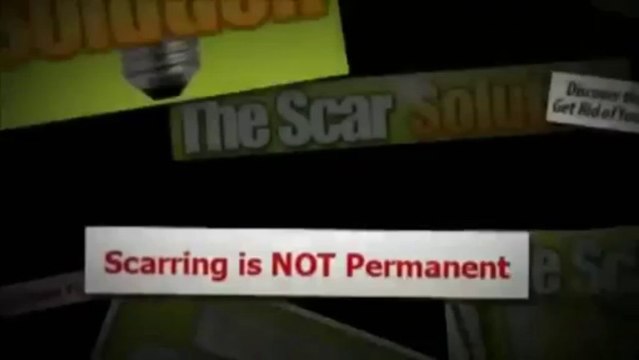 Acne Scar Natural Treatment - Scar Solution Reivew [Scar Solution]