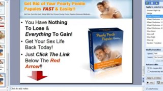 #1 Pearly Penile Papules Removal At Home - PPP Removal
