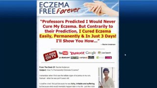 Eczema Free Forever: Review Examining Rachel Anderson's Program Released