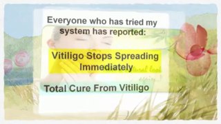 Symptoms Of Vitiligo - Natural Vitiligo Treatment system