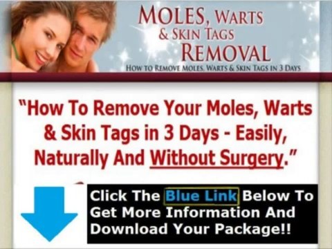 Moles Warts & Skin Tags Removal Pdf + Moles Warts Removal Review