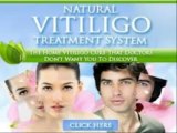 Natural Vitiligo Treatment System   Natural Vitiligo Treatment System pdf