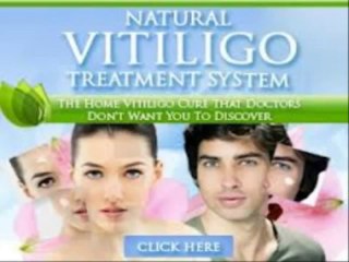 Natural Vitiligo Treatment System + Natural Vitiligo Treatment System pdf