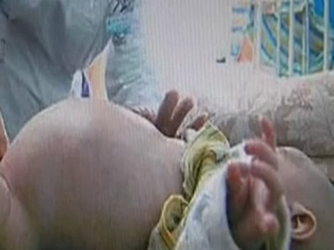 WTF 2 Year Old Gives Birth To Own Twin
