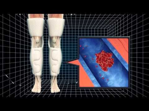 Leg wraps could save lives of stroke patients