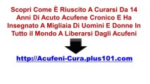 Miracolo Per Acufeni - Curare Gli Acufeni Olisticamente