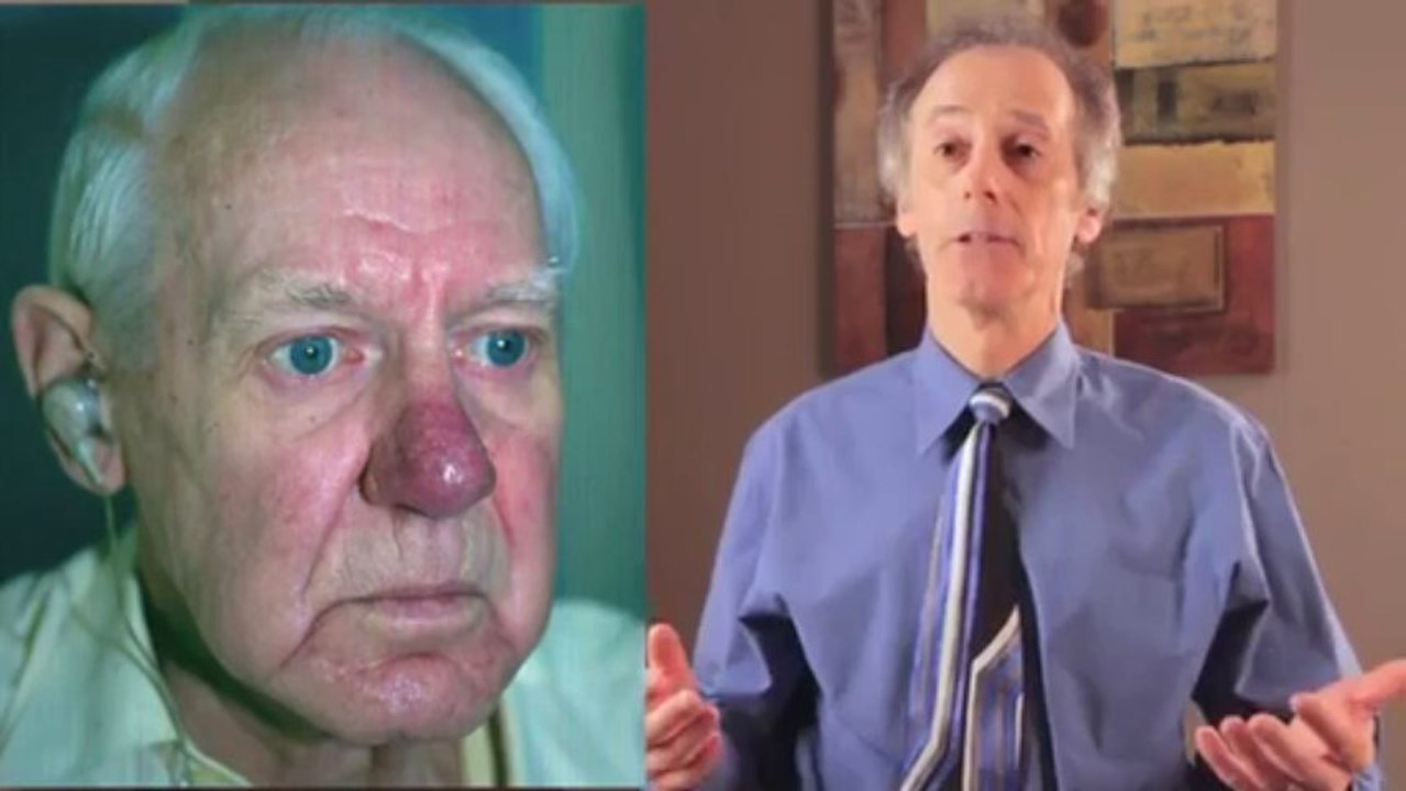 Rosacea