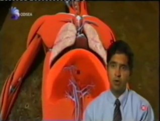 Lesion medular: Muerte por alcantarilla