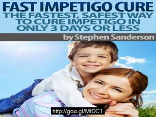 TOP Impetigo Treatment - Learn How to Cure Impetigo
