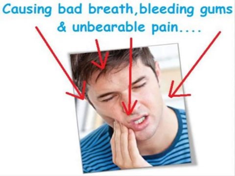 Rapid Dental Remedies Review [Real 100% and Honest]