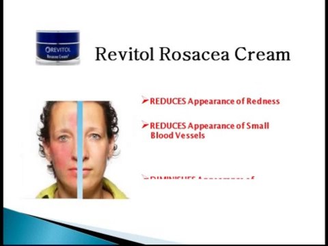 Buy Revitol Rosacea Treatment -Where to Buy Revitol Rosacea Cream