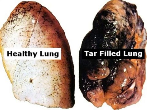 Lung Detoxification - Clean Your Lungs And Quit Smoking Review + Bonus