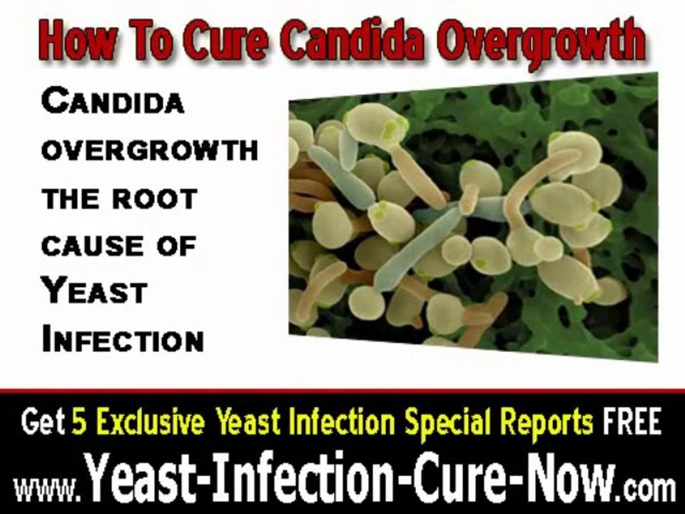 How To Cure Candida Overgrowth