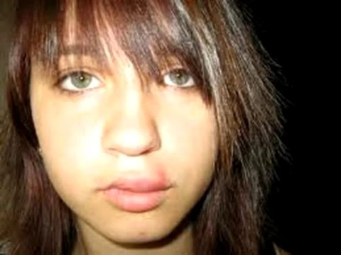 how to get rid of cold sores fast