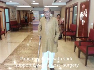 Best Knee Replacement Surgery In India - Gurgaon/ Delhi NCR