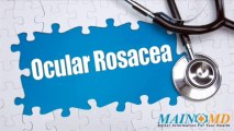 Ocular Rosacea ¦ Treatment and Symptoms