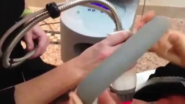 rosacea, skin pores, acne scars, pigment removal fraxel Sydney