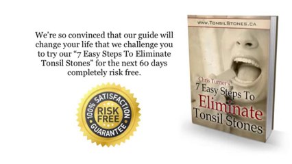 7 Easy Steps To Eliminate Tonsil Stones