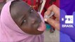 Somália sofre com surto de poliomielite após passar 6 anos livre da doença