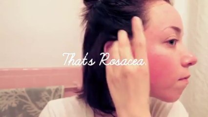 Easy Night Time Skin Care for Rosacea | pepper b.