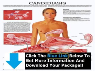 How To Cure Candida In Women + How To Cure Candida Overgrowth Naturally