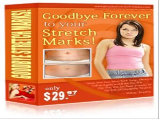 GOODBYE STRETCH MARKS REVIEW & DISCOUNT