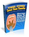 Tonsil Stones Secret Home Remedies Review + Bonus