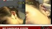 Op Dr Mustafa Ali YANIK Ameliyatsız Burun Estetiği ve Kulak Estetiği