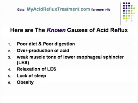 Acid Reflux Treatment- How to Cure Your Heartburn Naturally