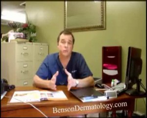 Vein removal and rosacea