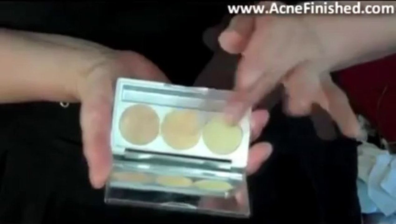 Cover up makeup for Redness, Rosacea & Acne