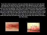 How To Get Rid Of Cold Sores Fast - Get Rid Fast Here