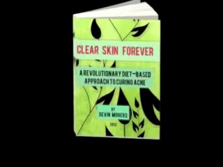 Clear Skin Forever Review   Secrets to Getting Clear Skin   Help Clear Skin Review
