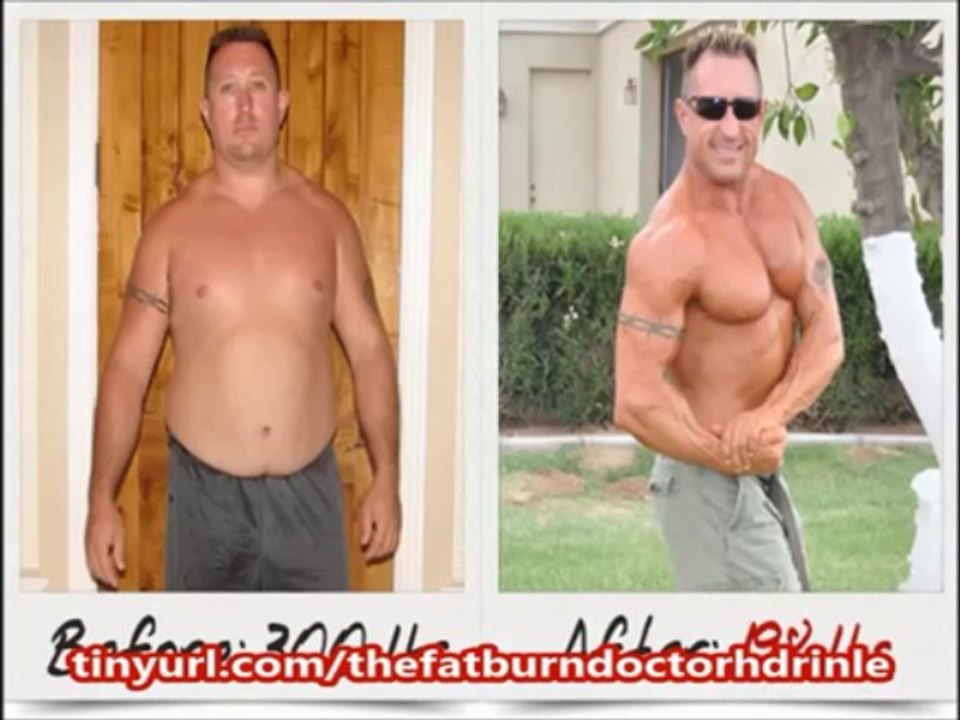 The Fat Burn Doctor Fast Weight Loss | Fat Burn Doctor Program
