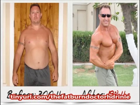 The Fat Burn Doctor Fast Weight Loss | Fat Burn Doctor Program