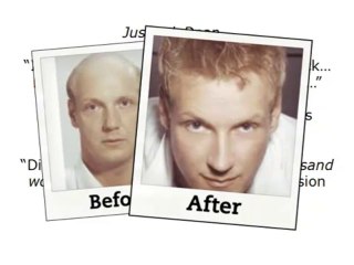 Hair Loss Blueprint / Holistic Regrowth System For New Healthy Hair