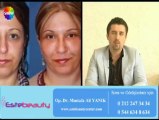 Yüz Germe Estetiği Op. Dr. Mustafa Ali Yanık